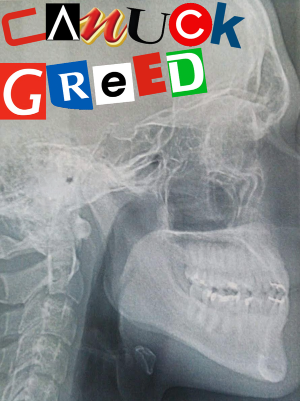 CanuckGreed
